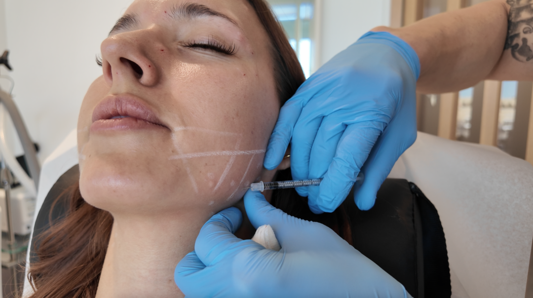 TMJ Treatment with Botox - Hear From Bridgette